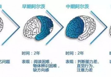 讓每位失智老人都活得更有尊嚴 